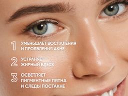 Крем-сыворотка против акне и пигментации / Azelais Corrective Cream-serum, 30 ml. - Icon skin фото 3