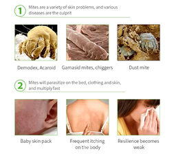 Мазь Aopen от подкожных клещей и вшей для людей и животных 20 мл  фото 2