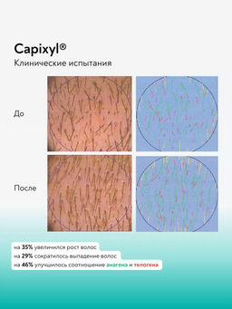 Careprost для ВОЛОС