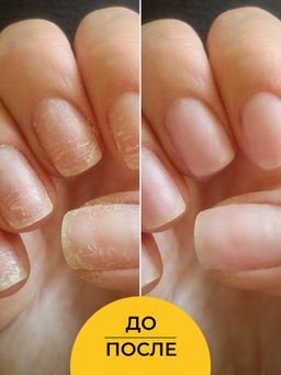 Концентрат масел для восстановления структуры ногтей - Siberina фото 7