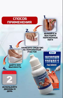 Эссенция от вросшегося ногтя ,для кутикуы, от грибка, для укрепления ногтей,20мл - Buro фото 4