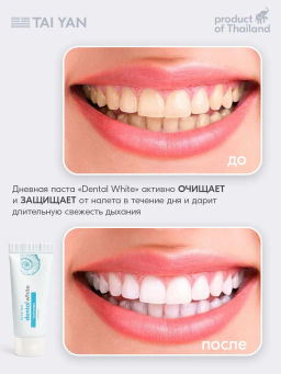 Тревел набор зубных паст 2*10 гр, 111-06 - Bonimed фото 6