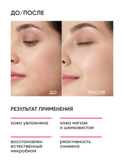 Крем для лица увлажняющий с пробиотиками - Icon skin фото 2