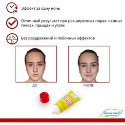 Крем-гель Следоцид-Цинковая Маска, 30мл. - Dr.kirov cosmetic company фото 4