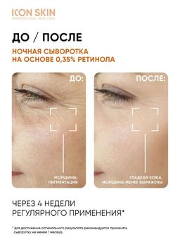 Ночная сыворотка на основе 0,35% ретинола GOLDEN RETINOL - Icon skin фото 5