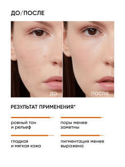 Пилинг для лица 25% кислотный миндальный - Icon skin фото 4