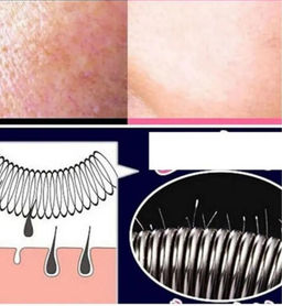 Эпилятор пружинный для лица, прибор для удаления волос