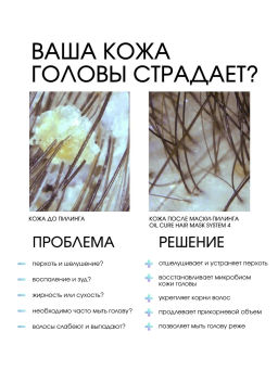 System 4 Терапевтическая маска-пилинг О, 75 мл - Sim sensitive фото 2