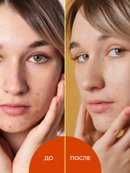 Тоник для лица с АНА-кислотами против черных точек и жирного блеска - Siberina фото 6