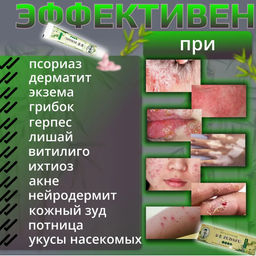 Зудафу Zudafu Семейный доктор Мазь Крем от псориаза, экземы и дерматита, 15 гр - Aopen фото 5