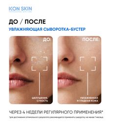 Увлажняющая сыворотка-концентрат Feel the Moist с гиалуроновой кислотой - Icon skin фото 5